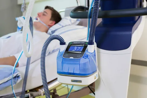 mechanical ventilation mechanical ventilation